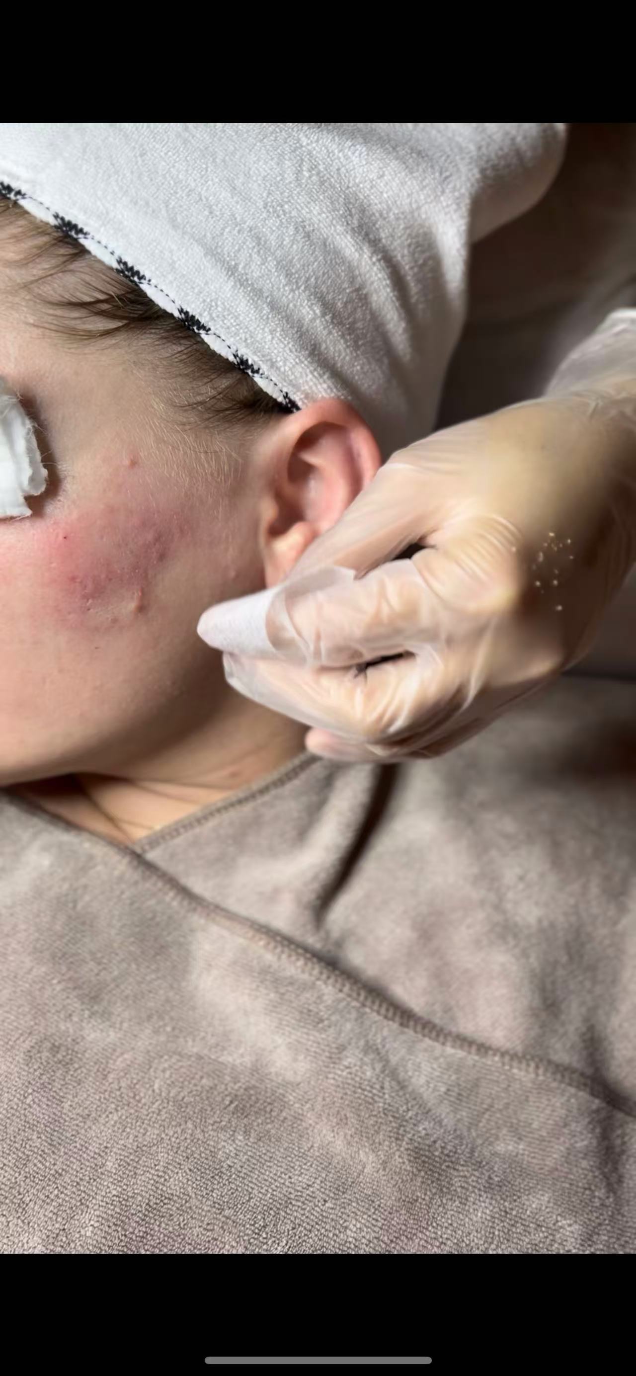 Deep Cleansing & Acne Treatment (90 mins)